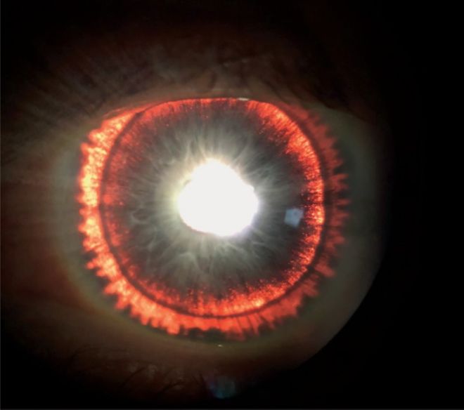 10 Most Shocking And Rarest Medical Cases Of The Year
